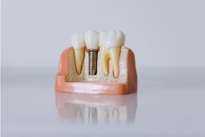RBA Dental Care